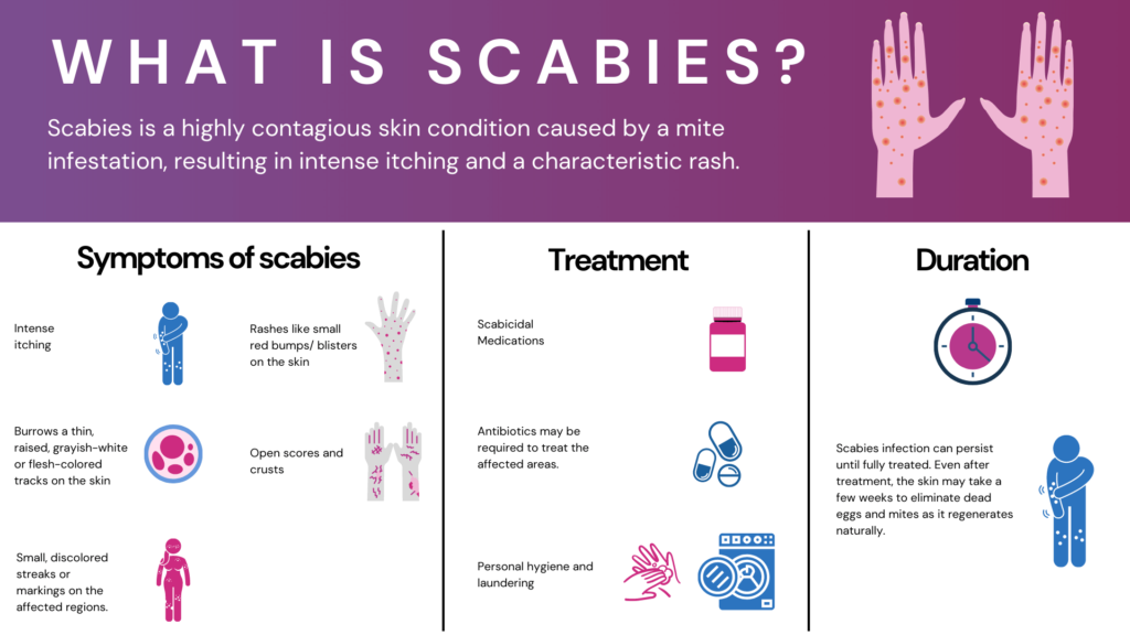 scabies