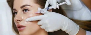 dermal fillers