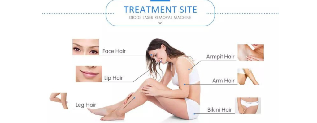 diode laser for hair removal