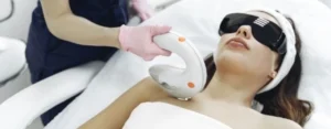 diode laser for hair removal